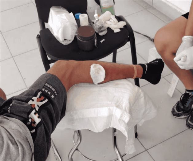 Migrante cubano afectado con gusano barrenador pide ayuda a Sheinbaum Migrante cubano afectado con gusano barrenador pide ayuda a Sheinbaum