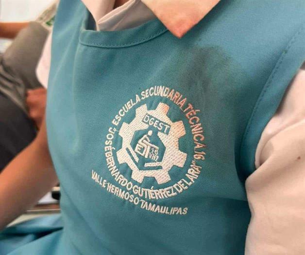 Estudiante sufre de fractura nasal Estudiante sufre de fractura nasal
