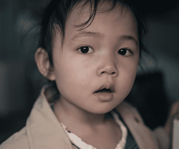 ¿Qué es el síndrome de Kabuki? Conoce sus principales síntomas ¿Qué es el síndrome de Kabuki? Conoce sus principales síntomas