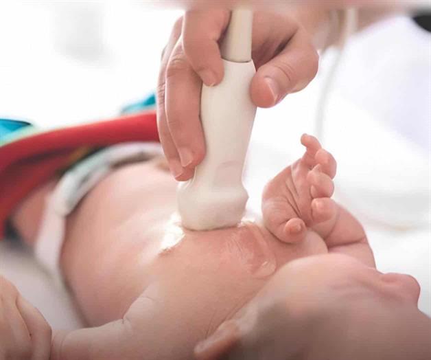 Logran con éxito cirugía cardíaca a bebé de dos días de nacido en Tampico Logran con éxito cirugía cardíaca a bebé de dos días de nacido en Tampico