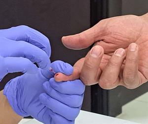 La diabetes tipo 2 segunda causa de muerte en México