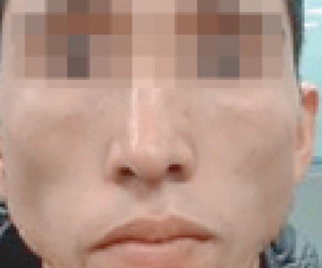 Buscan a sujeto que hirió a joven Buscan a sujeto que hirió a joven