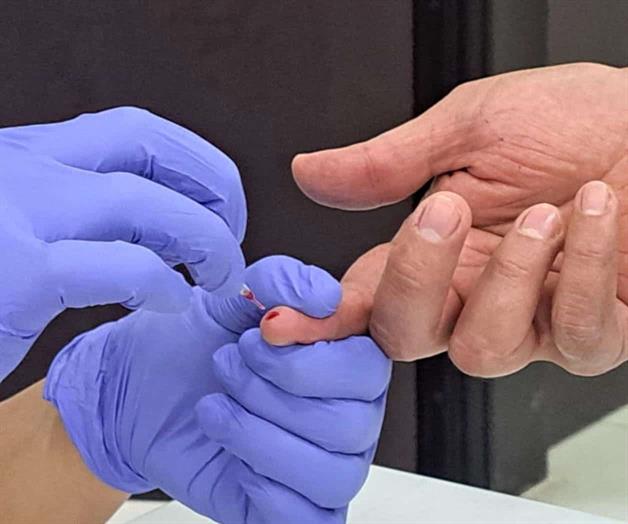 Detectan VIH en el CEDES Detectan VIH en el CEDES