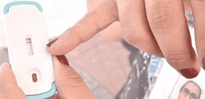 Incrementan muertes por Sida; no siguen el tratamiento