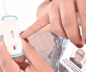 Incrementan muertes por Sida; no siguen el tratamiento Incrementan muertes por Sida; no siguen el tratamiento