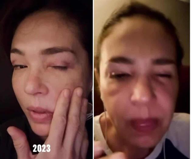 Reaparece Yolanda Andrade en redes, muestra cambios en su f&iacute;sico